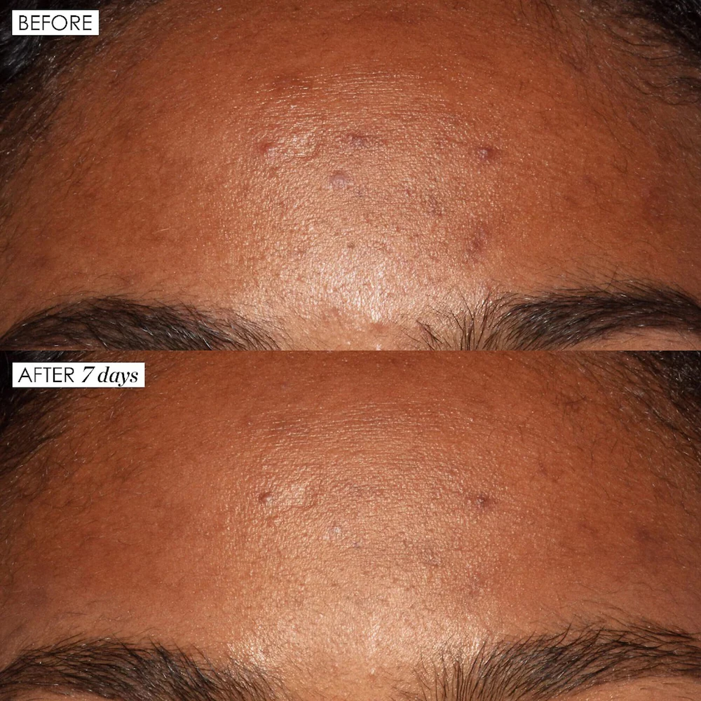 Good Genes All-In-One Lactic Acid Serum - Image 2